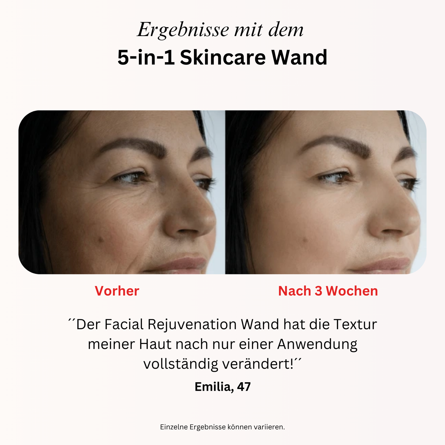 5-in-1 Skincare Wand